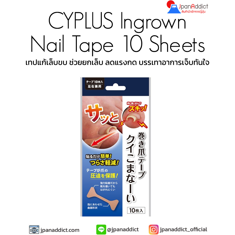CYPLUS Ingrown Nail Tape Kui-komanai 10 Sheets